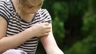 ¿Usas repelentes mosquitos? Este es el impacto real en niños y mascotas