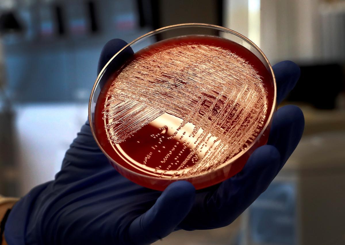 GRAF936. MADRID, 12/09/2019.- Vista de un cultivo de listeriosis en una placa de Petri, este jueves en el Laboratorio de Listeriosis del Centro Nacional de Microbiología de Madrid.