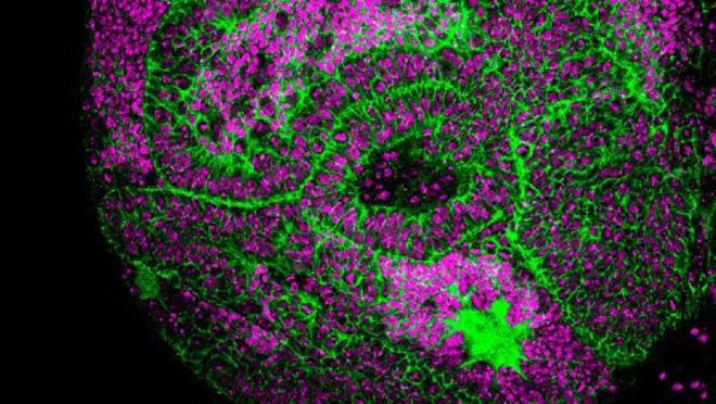 Imagen del estudio sobre los genes germinales y su papel en el desarrollo de tumores cerebrales en la mosca Drosophila