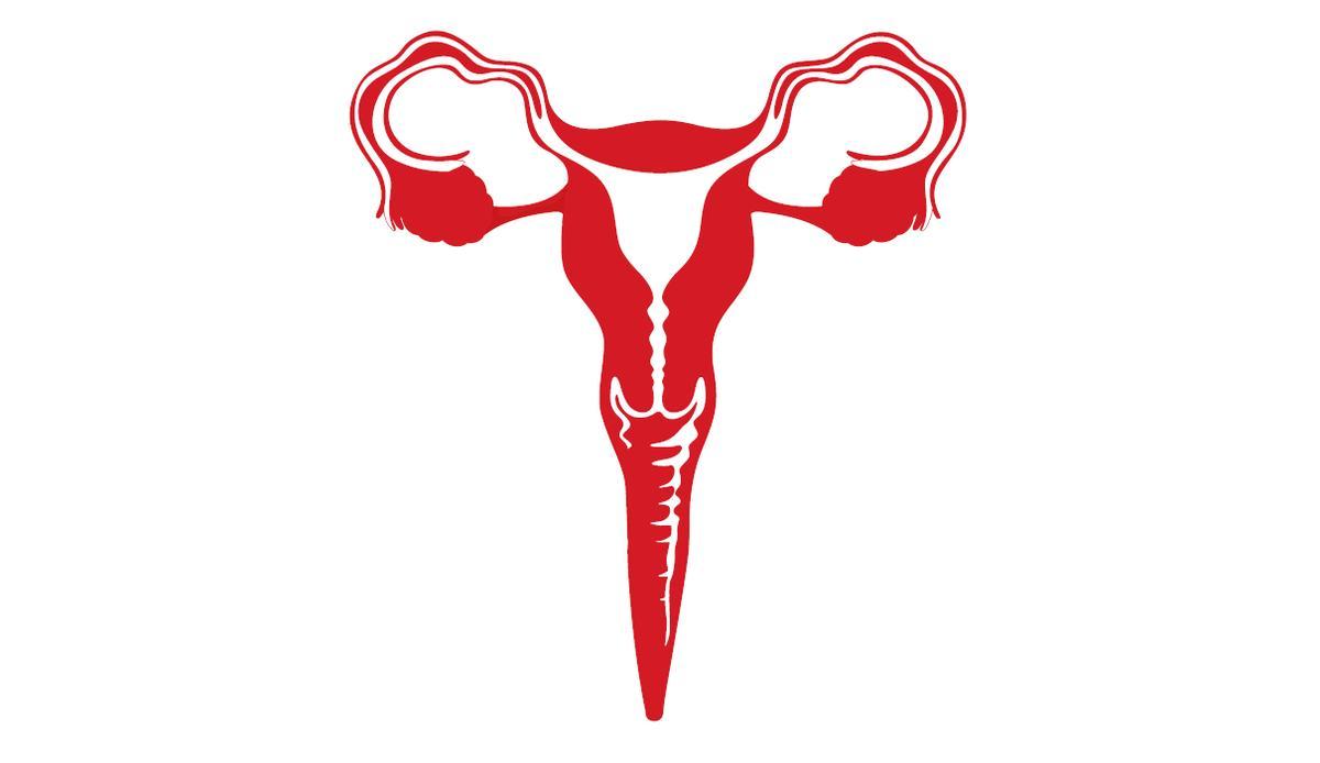 Ilustración sobre el aborto