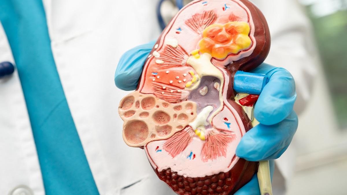 La hipertensión arterial (HTA) es una de las principales causas de enfermedad y mortalidad cardiovascular a nivel mundial.