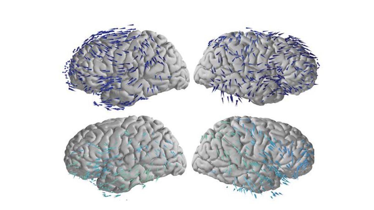 Las direcciones de propagación de ondas cerebrales en las funciones de memoria revelan cómo el cerebro coordina rápidamente la actividad y comparte información en múltiples regiones.