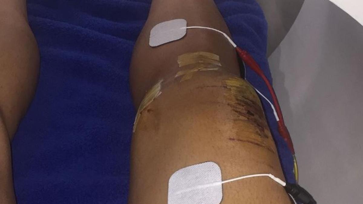 Sergio Lozano comparte en Instagram su recuperación de su lesión en la rodilla