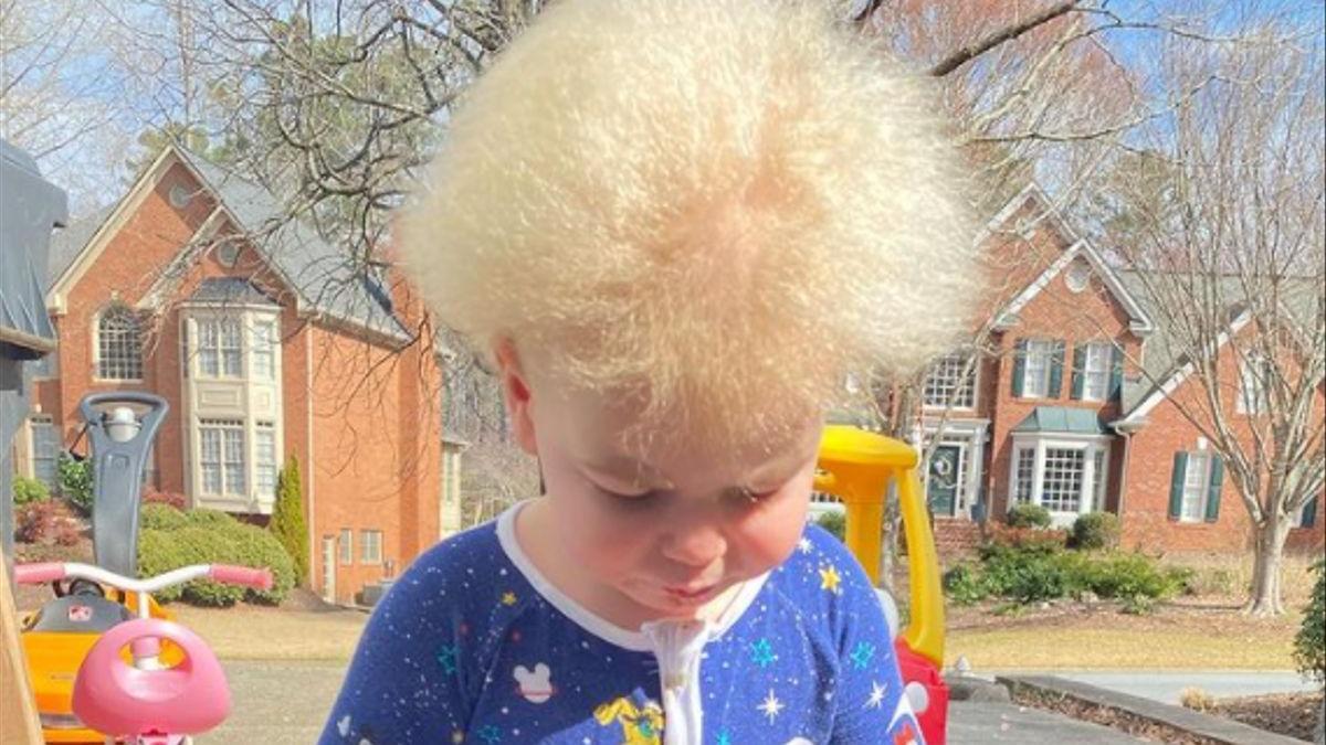 Una imatge del petit Locklan, que s&#039;ha fet viral a Instagram per patir la &#039;síndrome dels cabells que no es poden pentinar&#039;