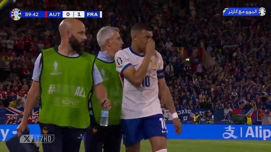 Mbappé se rompió la nariz en la Eurocopa 2024