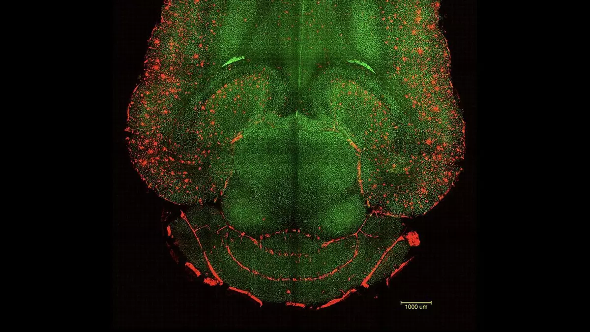 Científicos logran revertir el alzhéimer en ratones con tratamiento innovador