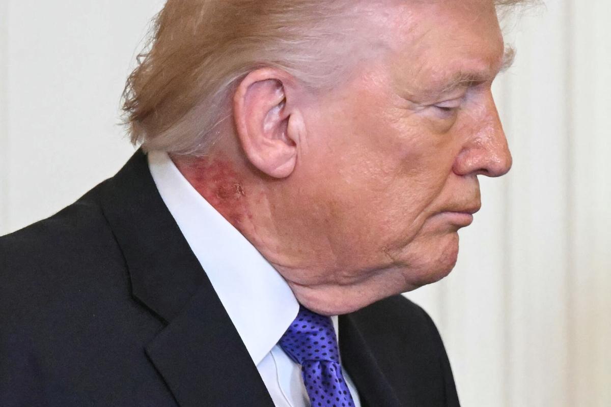 El presidente de los Estados Unidos, Donald Trump, observa durante una ceremonia de entrega de la Medalla de Honor en el Salón Este de la Casa Blanca el 2 de marzo de 2026, en Washington, D.C