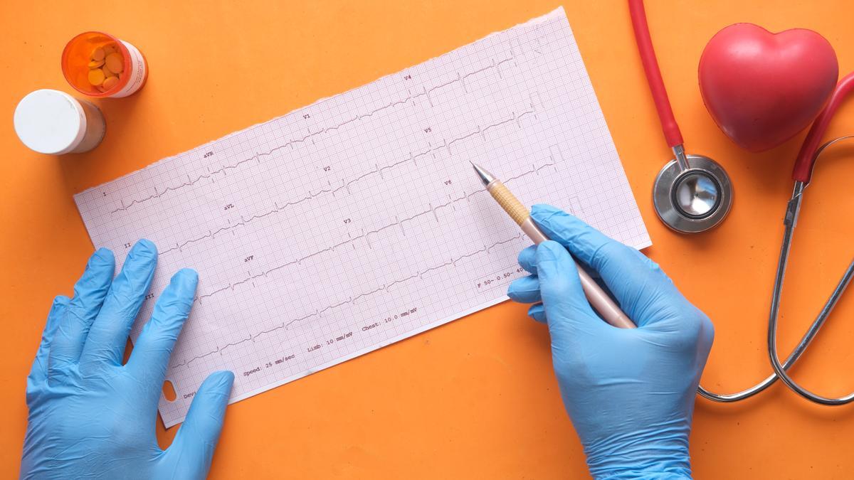 Avance español sobre la miocardiopatía dilatada