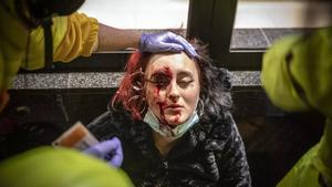 La mujer herida en un ojo presuntamente por una bala de foam de los Mossos en una protesta contra el encarcelamiento de Pablo Hasél, en Barcelona.