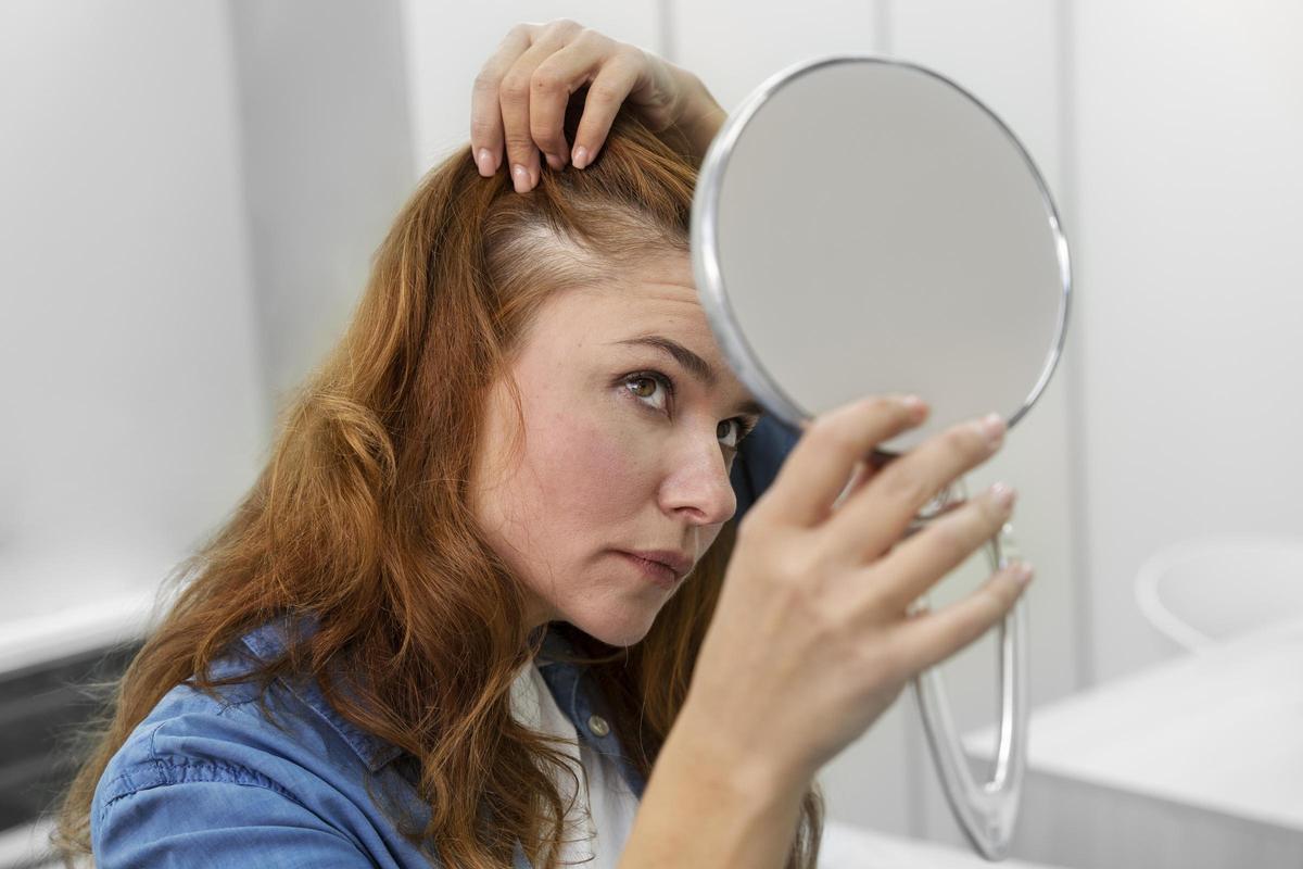 Si notas una pérdida excesiva de cabello prolongada durante más de 6 meses, ponte en manos cualificadas cuanto antes.