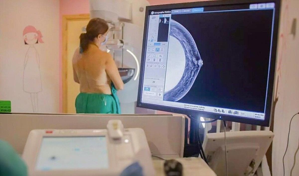 Una mujer se somete a una mamografía.