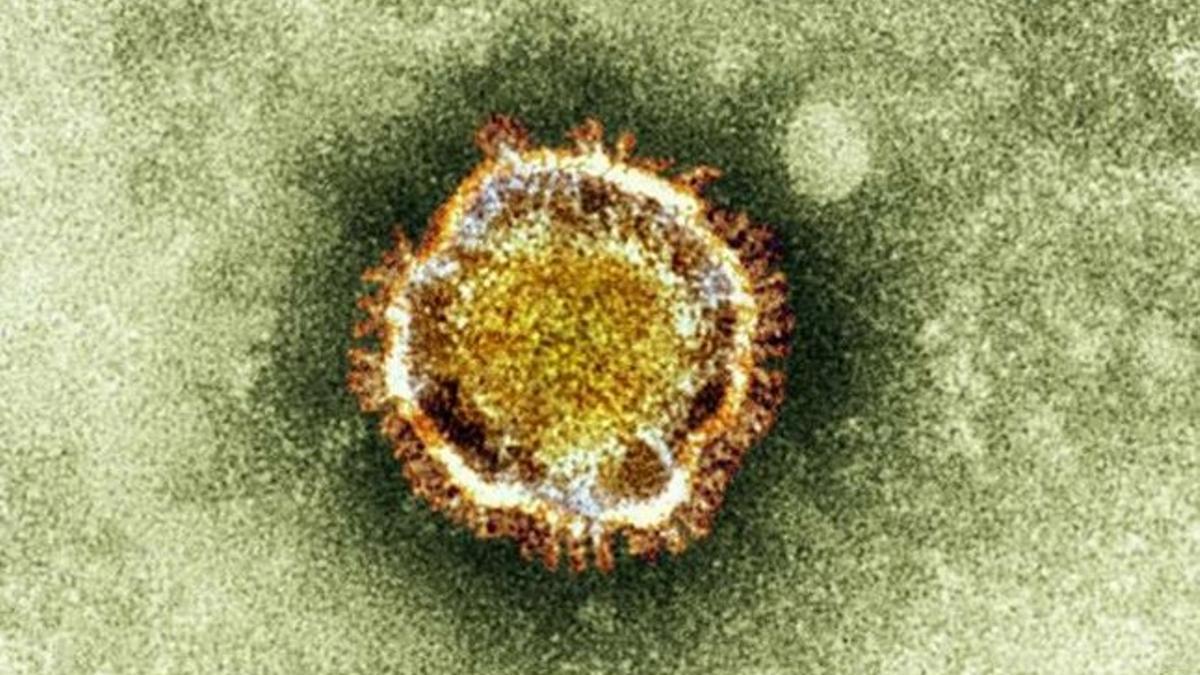 Imagen al microscopio del nuevo coronavirus NCoV, identificado por primera vez el año pasado.