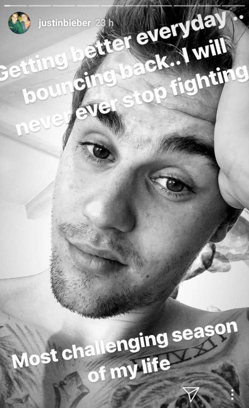 Instagram stories de Justin Bieber