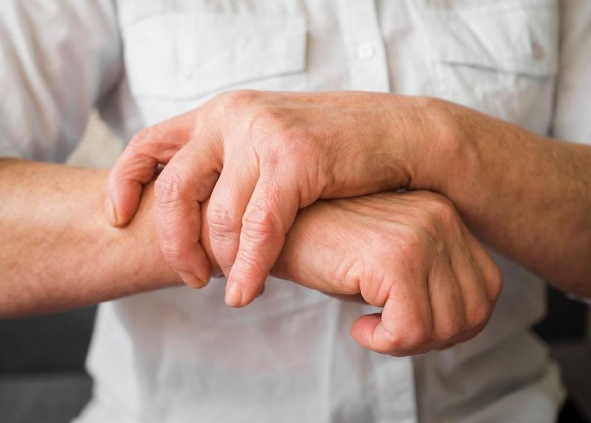 Artrosis, imagen de archivo