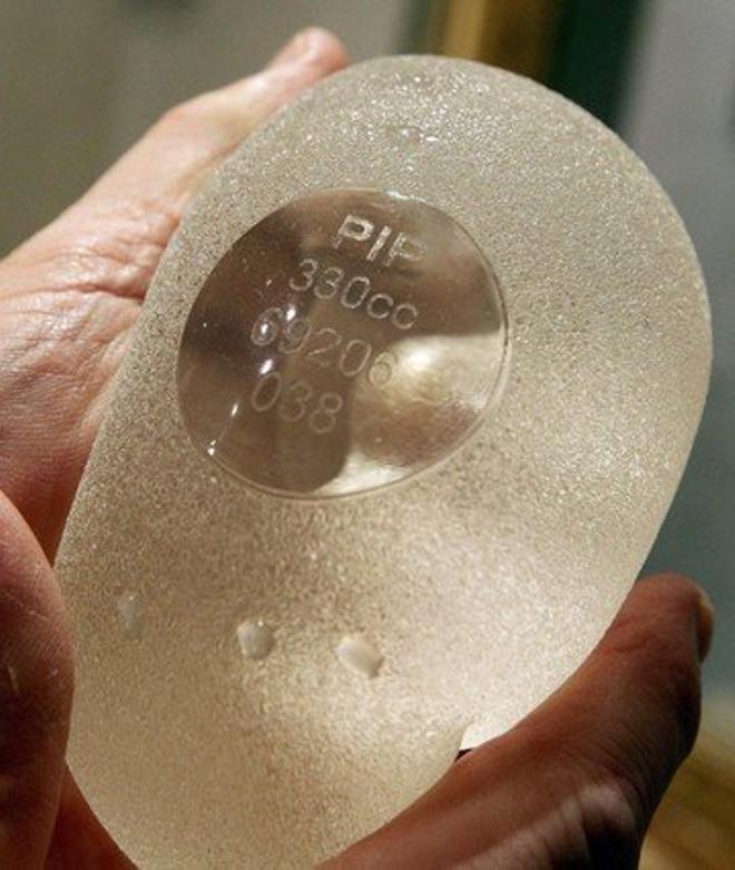 La defensa de los implantes PIP afirma que no se ha demostrado su peligro
