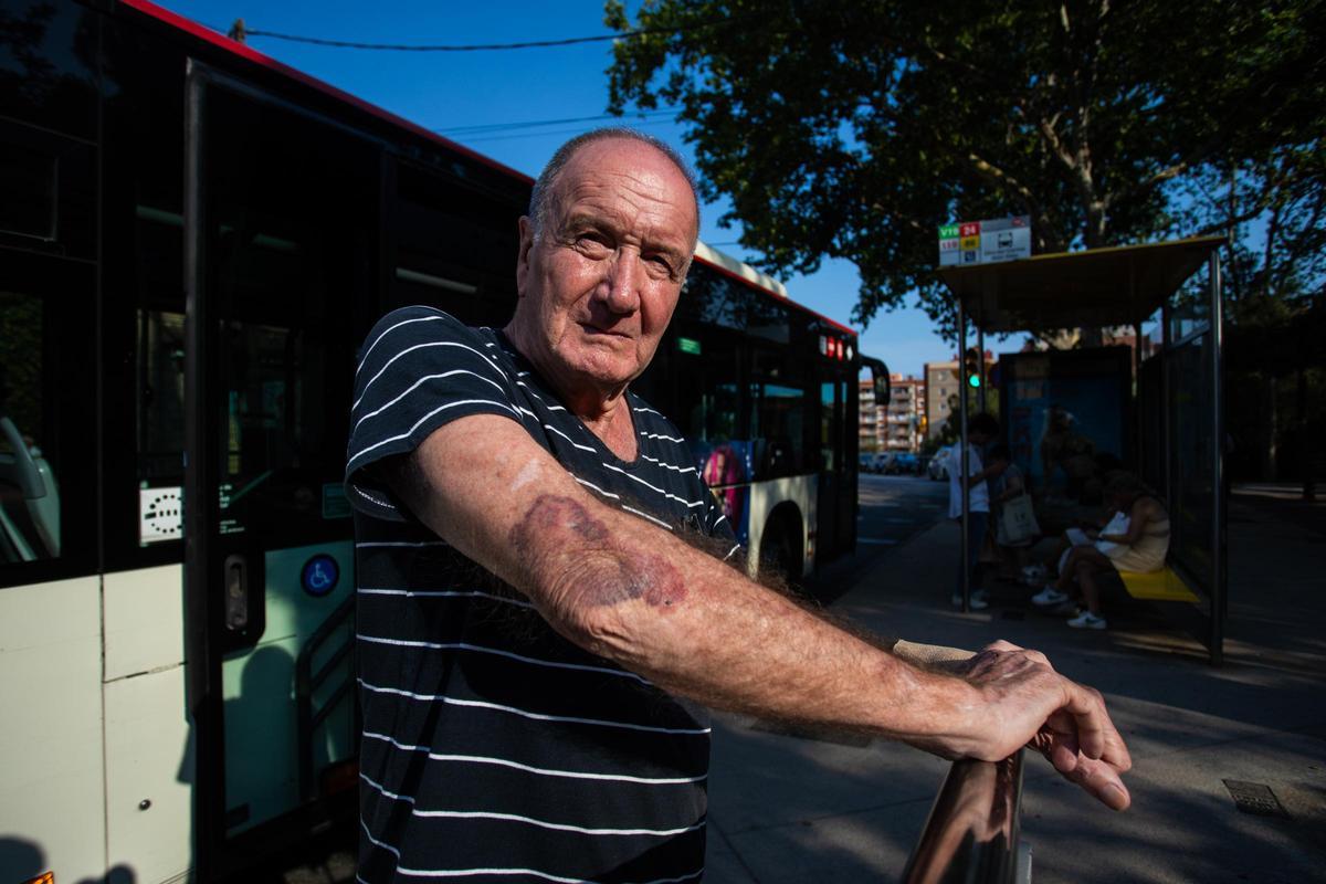 El veí apallissat al Turó de la Rovira: «La tanca dels búnquers no serveix per a res. N’hi continuen pujant centenars» El veí apallissat al Turó de la Rovira: «La tanca dels búnquers no serveix per a res. N’hi continuen pujant centenars»