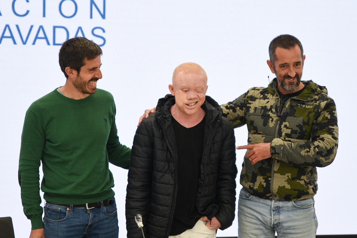 Cavadas reconstruye la cara a un paciente albino