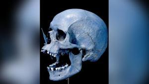 Cráneo atravesado por una flecha, uno de los elementos del neolítico analizados.