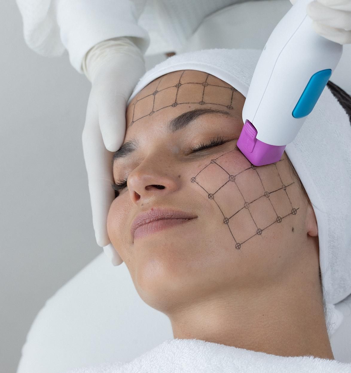 la gran inversión en colágeno»