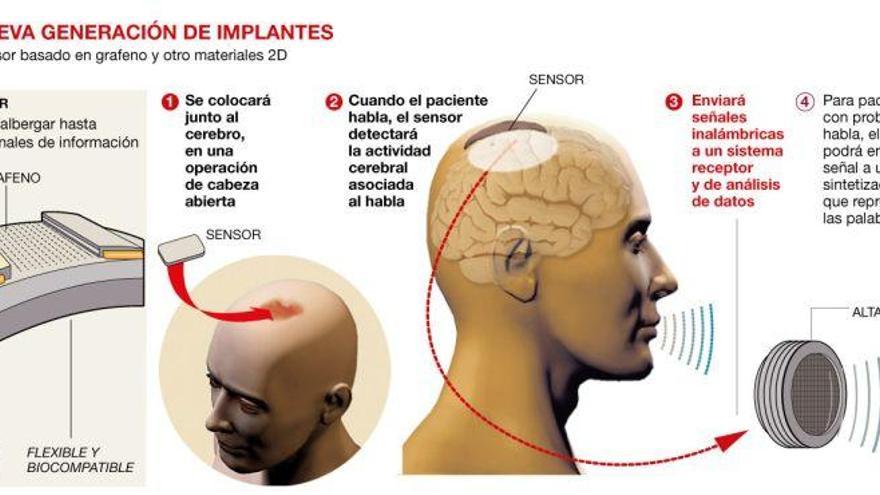 La nanotecnología alumbra una nueva generación de implantes cerebrales