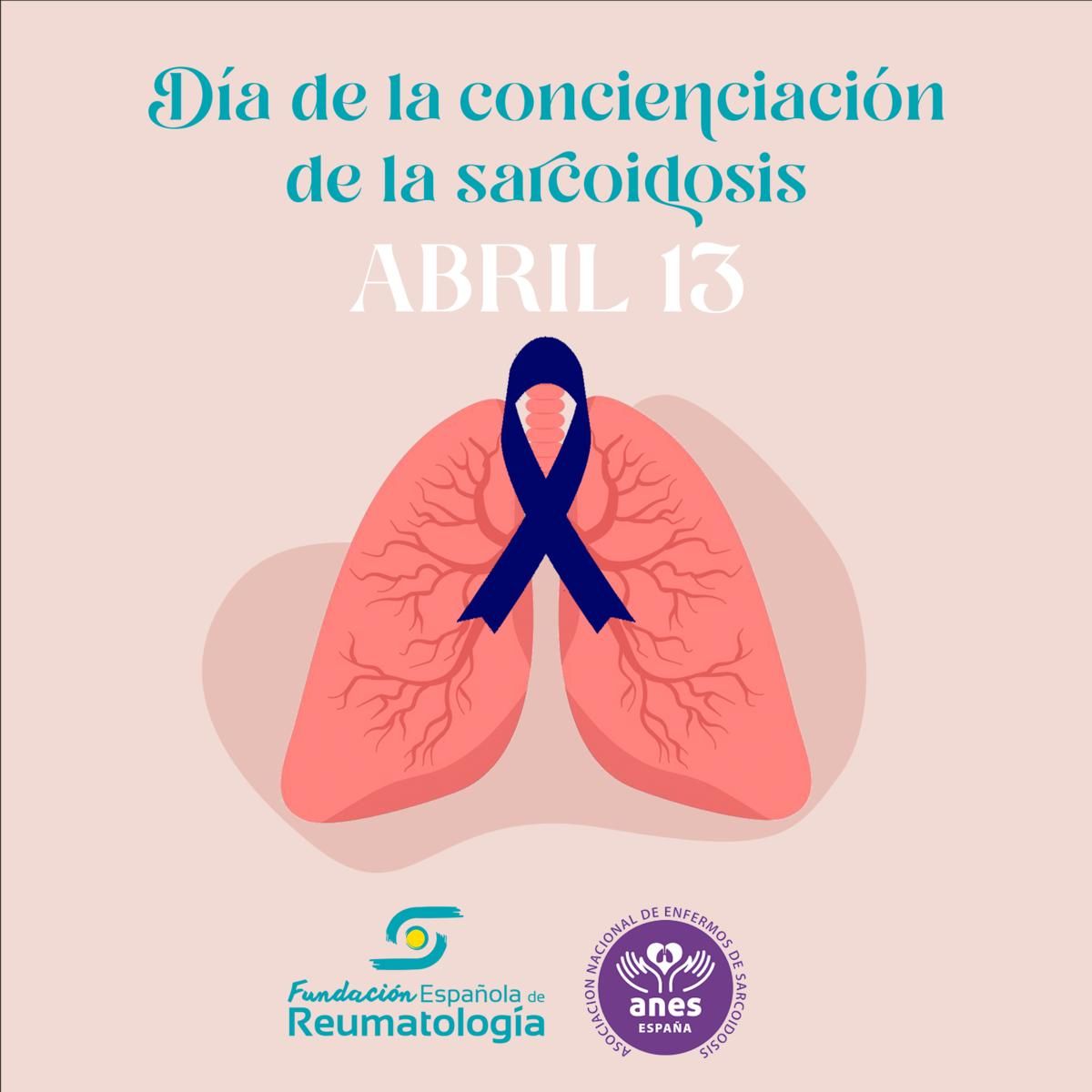 Según los datos que maneja la Sociedad Española de Reumatología, es una enfermedad minoritaria, cuya prevalencia se sitúa entre los 10 y los 20 casos por 100.000 habitantes