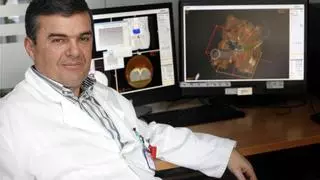 Carlos Ferrer, oncólogo del Hospital Provincial de Castellón: «Trabajamos en la radioterapia del siglo XXI»
