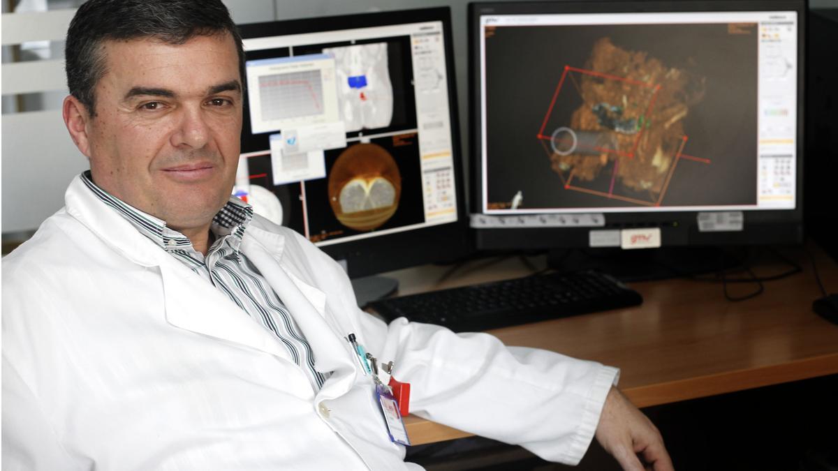 El doctor Carlos Ferrer es director científico de la Fundación del Hospital Provincial y jefe de Oncología Radioterápica.