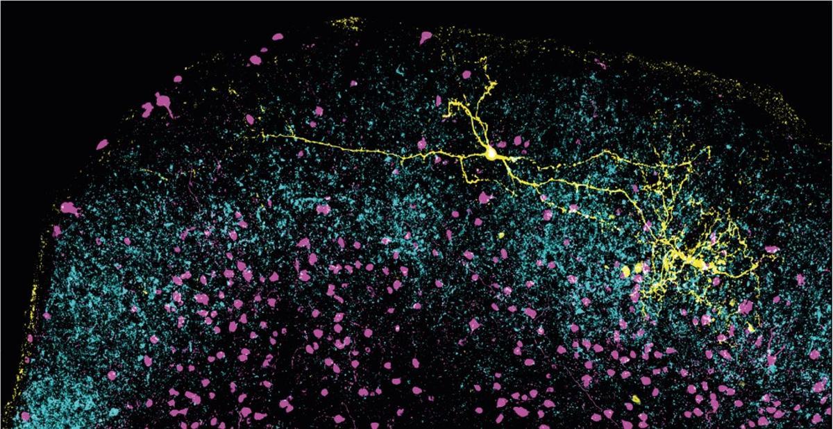 Una neurona inhibitoria (amarilla) se extiende a lo largo del colículo superior, mostrando una compleja red de conexiones que podría ayudar a suprimir señales visuales del entorno. Las terminales de células ganglionares de la retina se muestran en cian y otras neuronas inhibitorias marcadas en magenta. Imagen confocal realizada por Peng Cui
