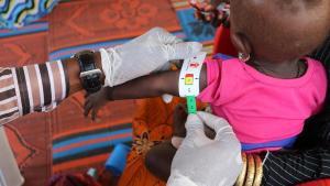 Archivo - Una niña con desnutrición en Nigeria