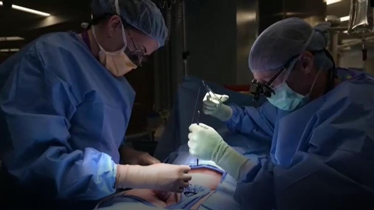 Se trasplanta con éxito el riñón de cerdo a una mujer en muerte cerebral