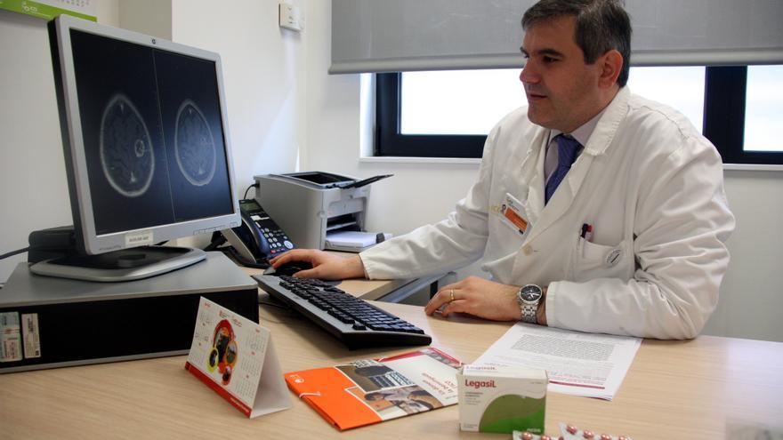 Investigadors gironins troben una manera per augmentar l&#039;eficàcia de la radioteràpia en casos de metàstasis cerebrals