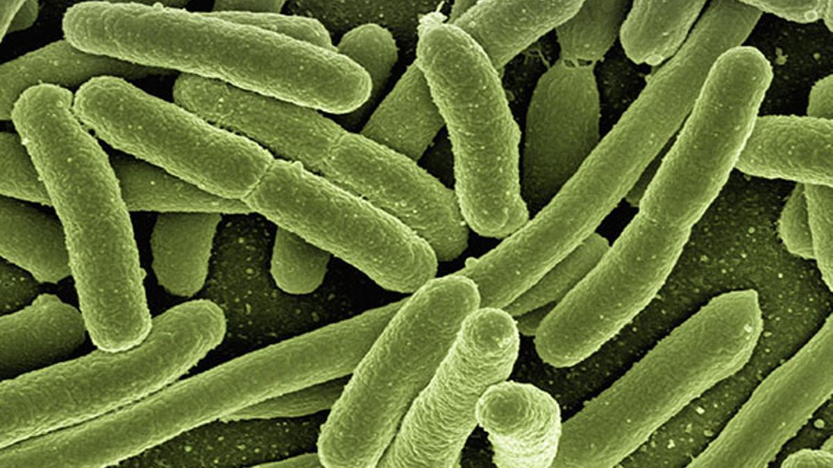Escherichia coli, uno de los tres principales patógenos en la lista de objetivos de la Organización Mundial de la Salud.