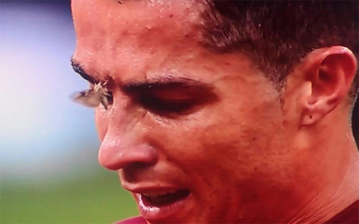 La lesión de Cristiano en imágenes