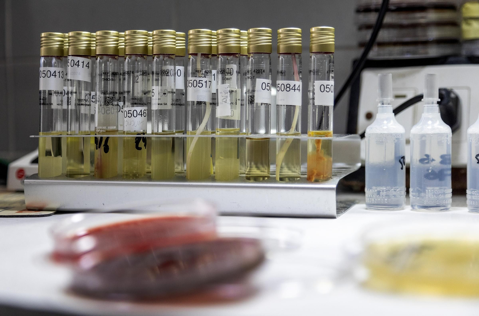 Protocolo para optimizar la respuesta rápida en código sepsis en Alicante