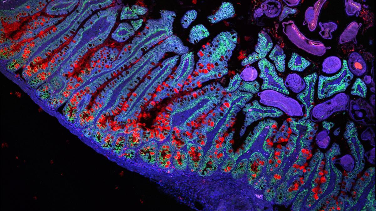 Human Cell Atlas、医療の「革命」に近づく