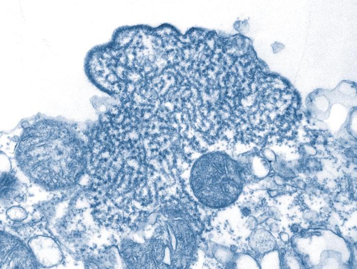 Virus Nipah