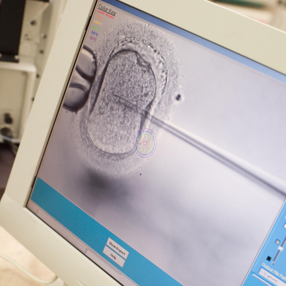 Fecundación In Vitro - ICSI.