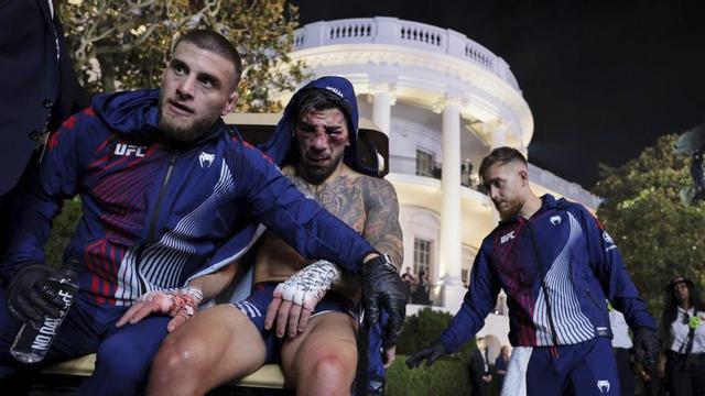 Topuria, ensangonat, després de patir una pallissa en la seva baralla contra Gaethje.  | JONATHAN ERNST / REUTERS