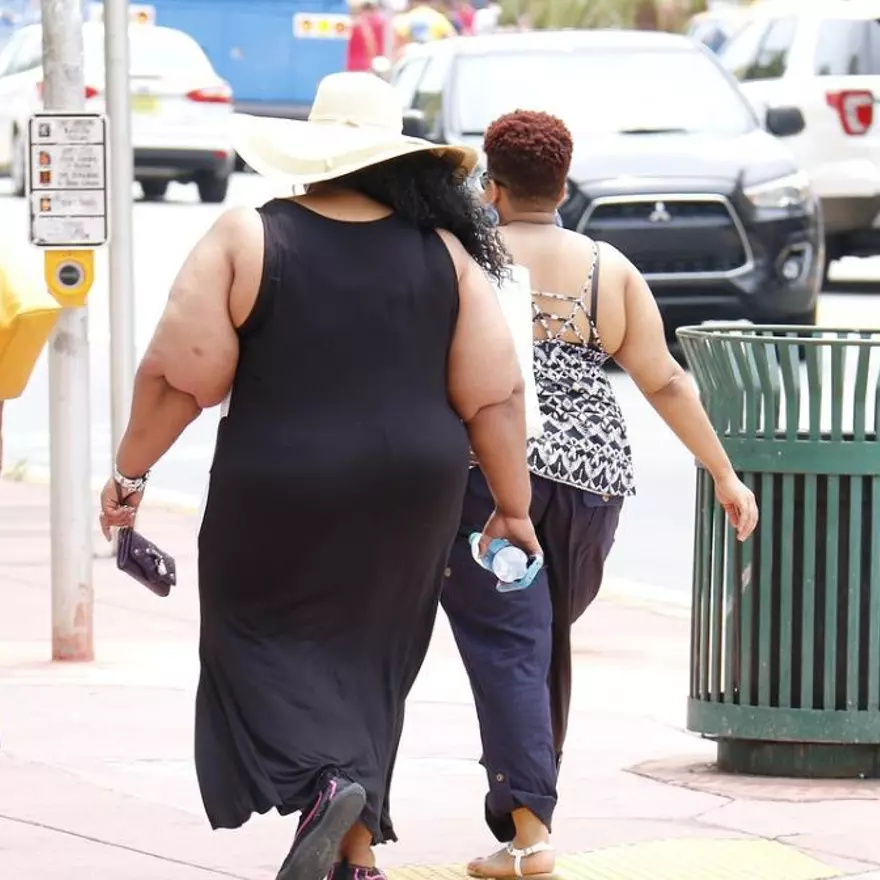Coste económico de la obesidad