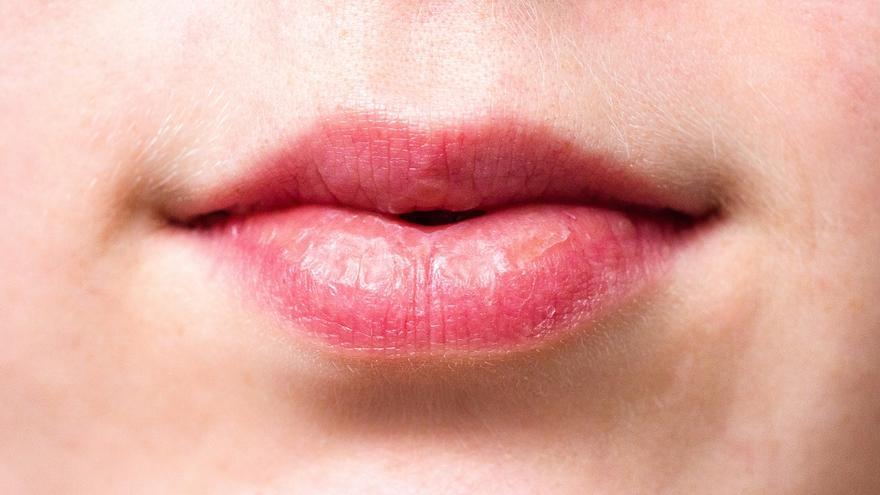 Los remedios naturales más efectivos para los labios secos y cortados por el frío