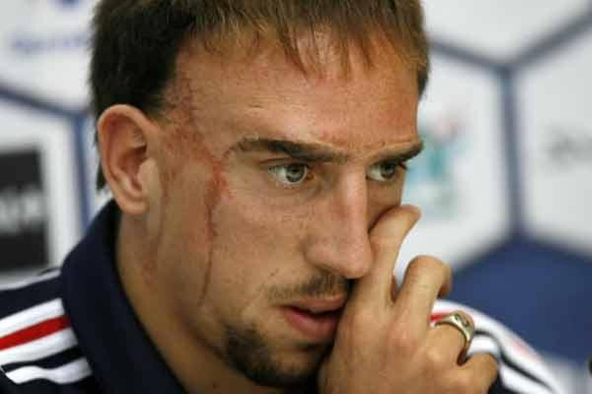 El futbolista internacional francés Frank Ribéry.