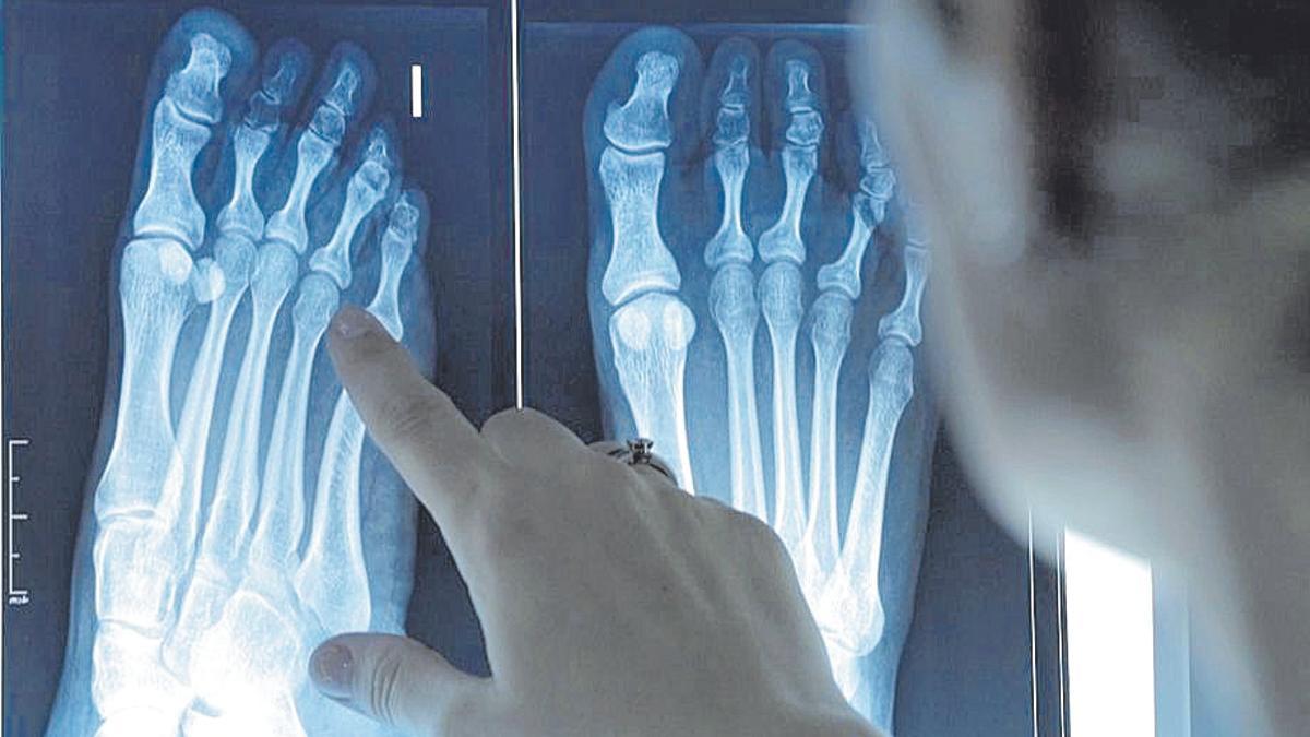 Un podólogo revisa una radiografía de pies.