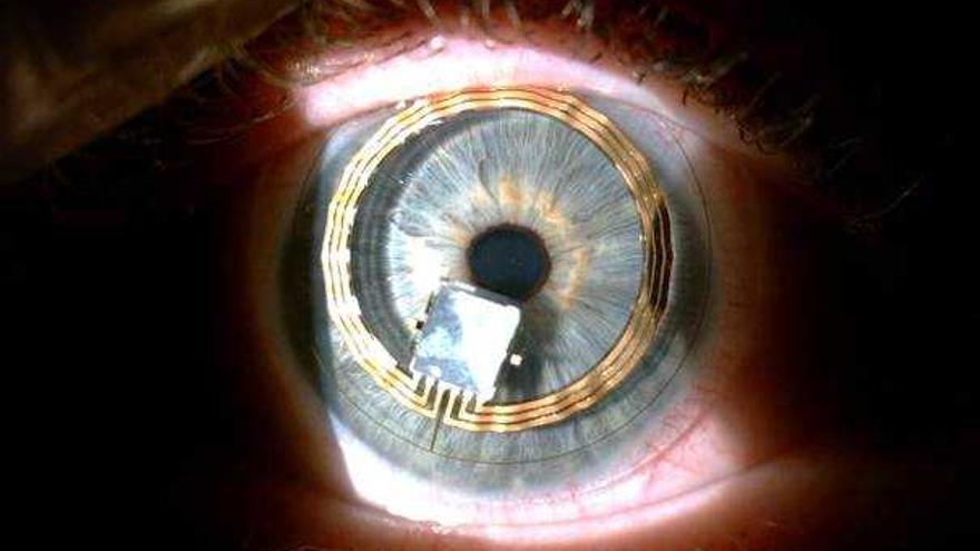 El Hospital de Torrevieja implanta lentillas con microchip para controlar  el glaucoma - Información