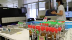 La vaga de tècnics de laboratori frena anàlisis no urgents