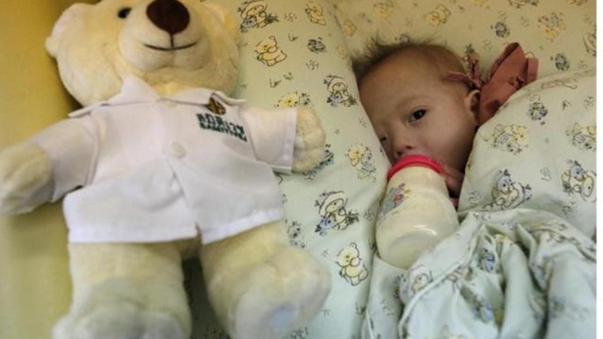 Gammy, el bebé de siete meses con síndrome Down, que está ingresado en un hospital de la provincia de Chonburi (Tailandia).