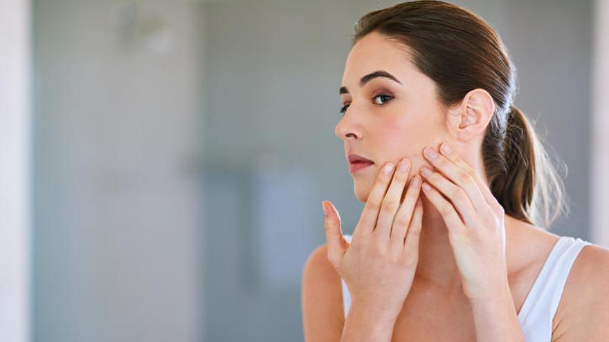 El acné es cada vez más común entre adultos.