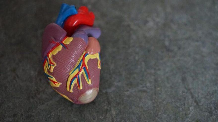 ¿Qué es un aneurisma de aorta abdominal? ¿Se puede tratar?