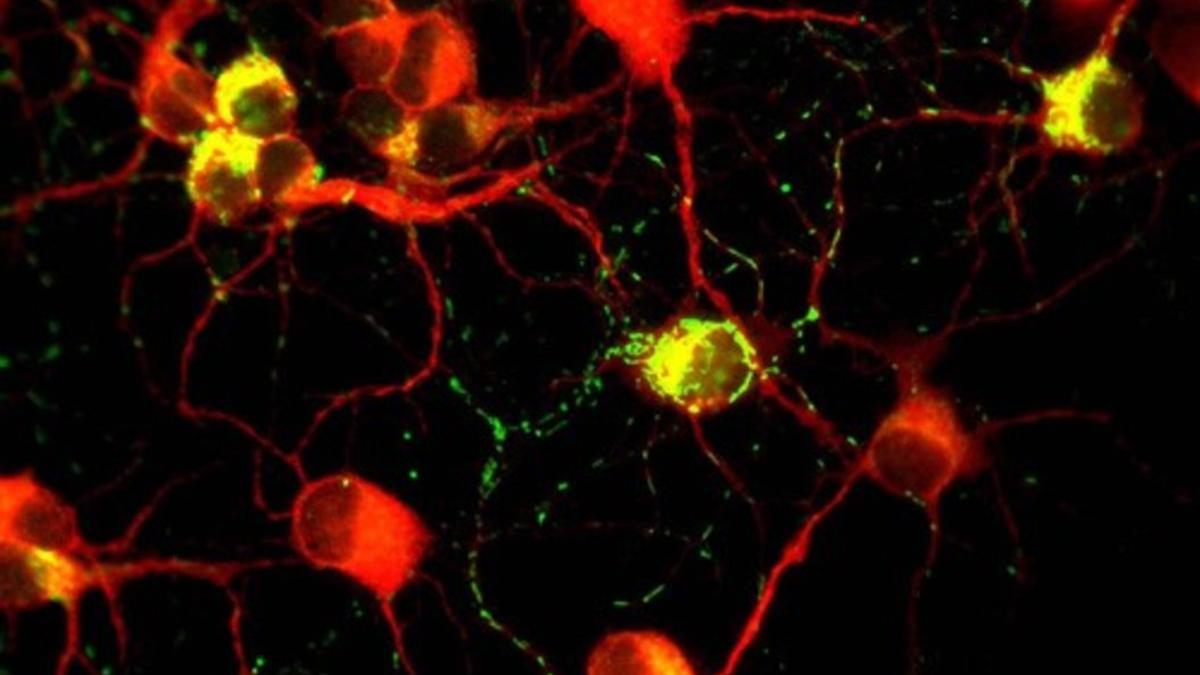 frataxin neurons big 2