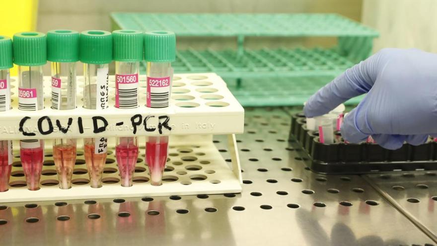 Muestras PCR en el hospital San Agustín de Avilés.