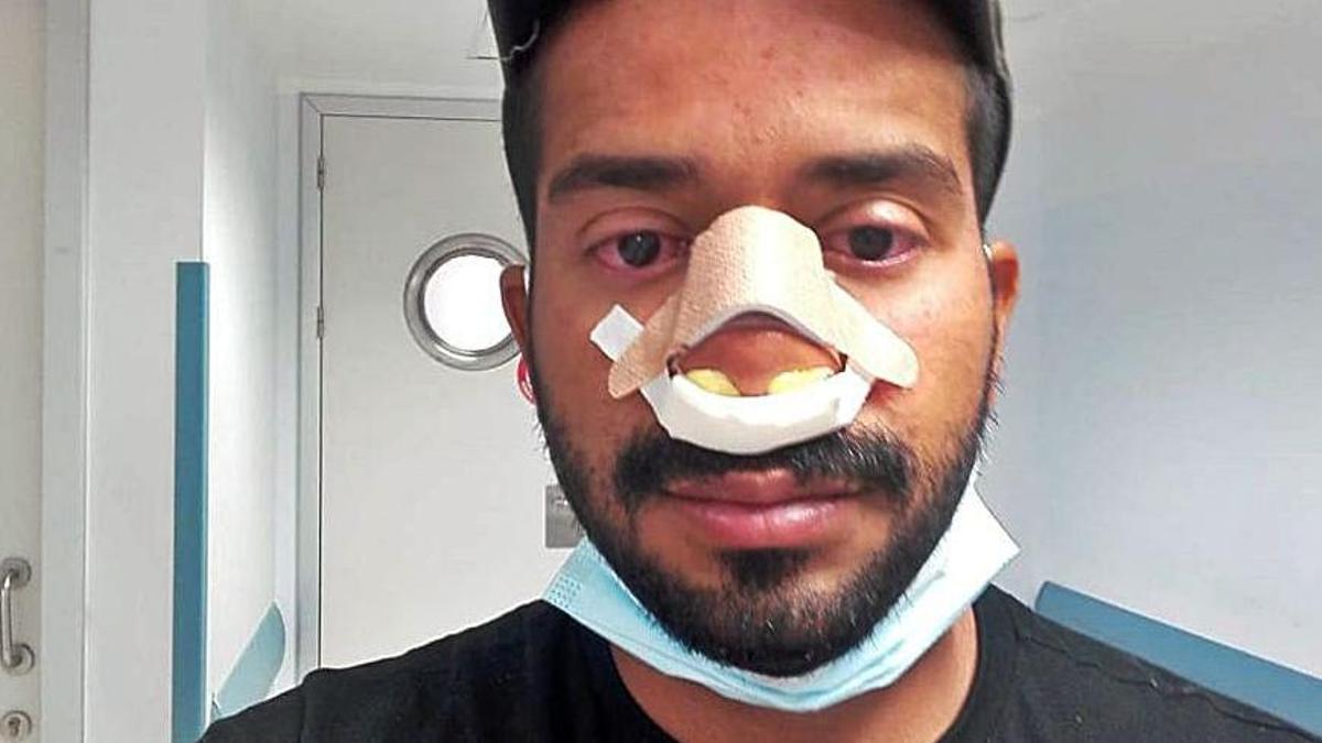 Rafael Parra, en el hospital, con el vendaje sobre su nariz rota. | LEVANTE-EMV